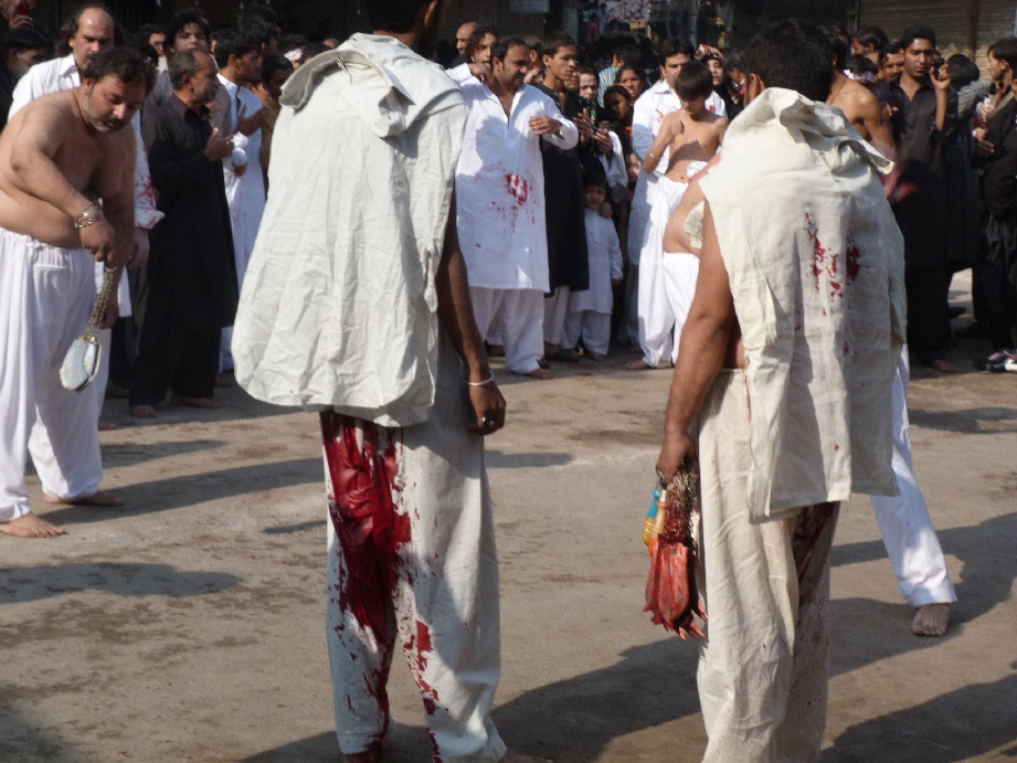 webassets/8bloodied.JPG